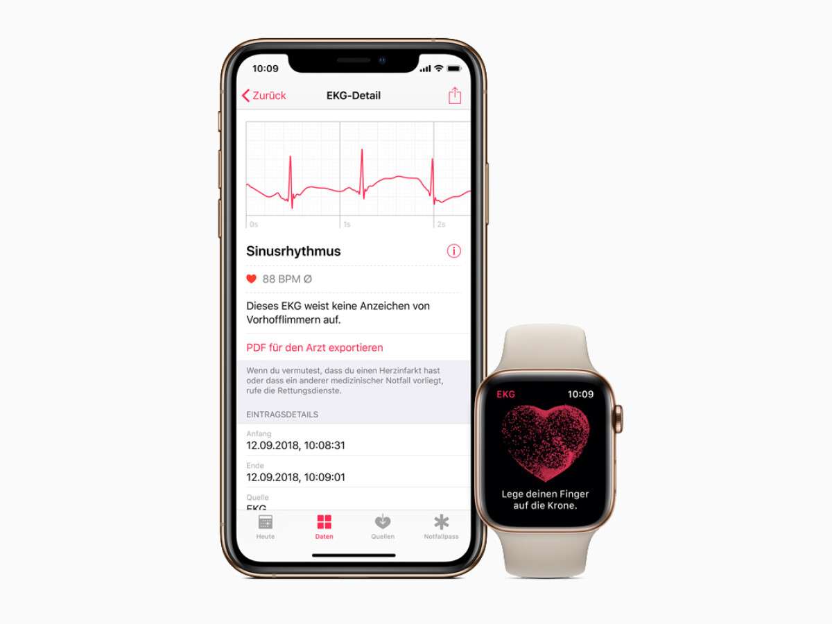 Apple Watch Series 4: watchOS 5.2 bringt EKG-Funktion nach Deutschland